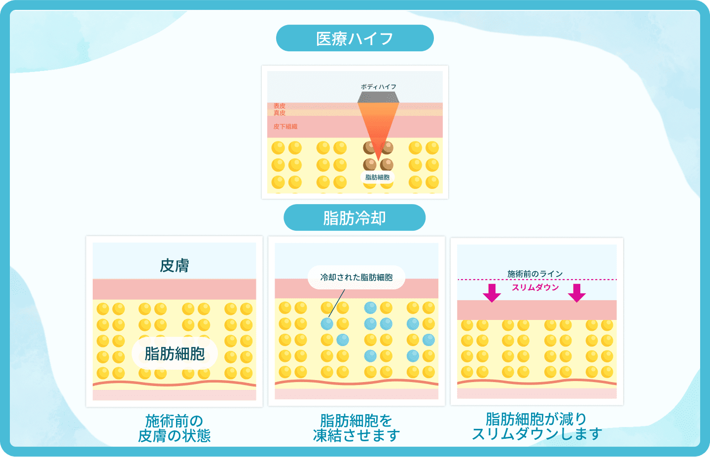 痩身サロンとの違いは？医療痩身ならではのメニューとは？デメリット、注意点はあるの？